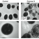 Illustration for article titled Degradable Nanoparticles Bludgeon Antibiotic-Resistant Bacteria